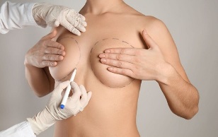 krūtų padidinimo operacija metodai