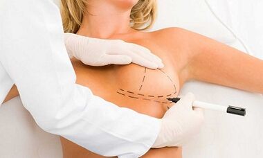 Kaip padidinti implantų smegenis