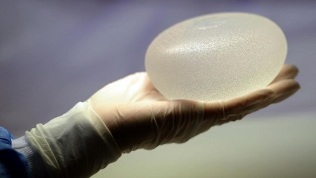 krūtų padidinimas riebalais - silikono alternatyva